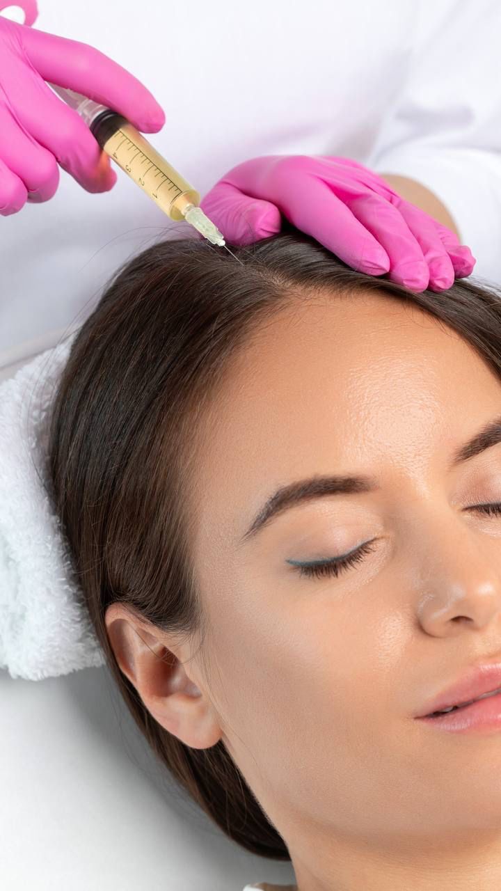 Mésothérapie Capillaire