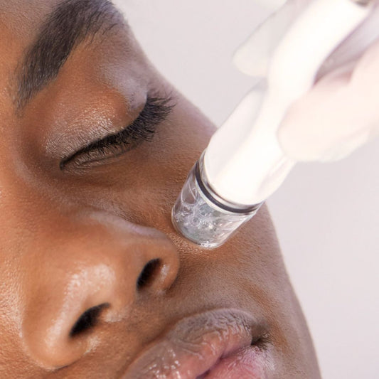 Microneedling
