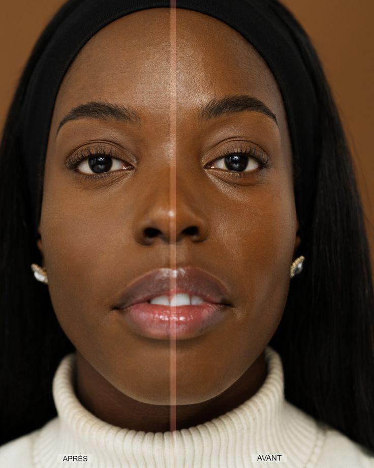 Photo Rajeunissement