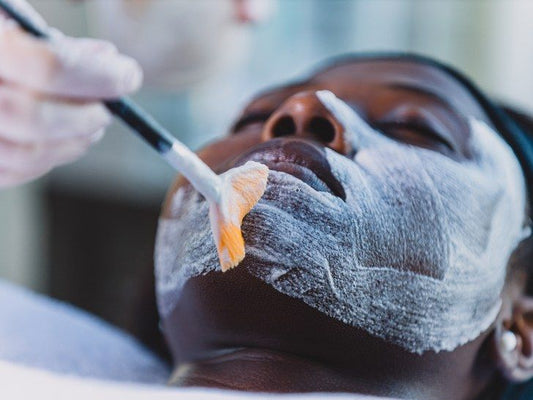 Peeling Chimique (30%)