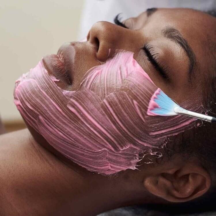 Peeling Chimique (30%)