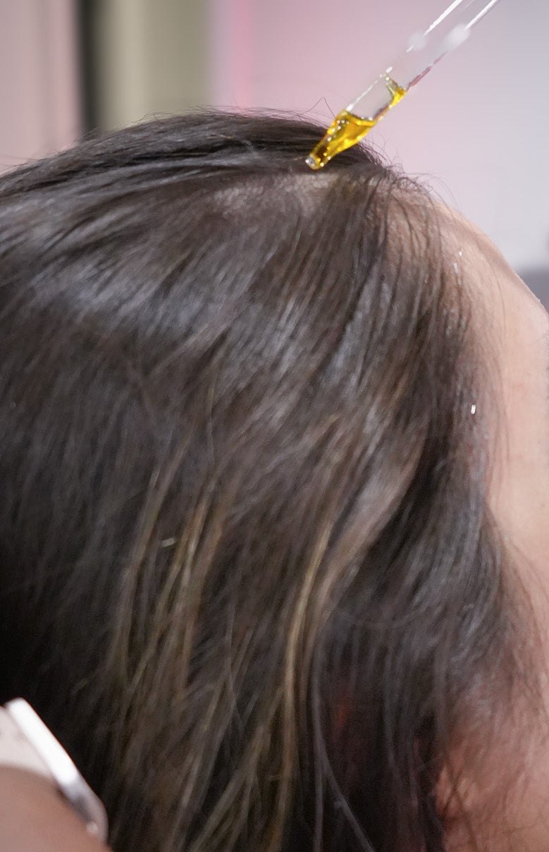 Person applying oil to another person's hair with a dropper.