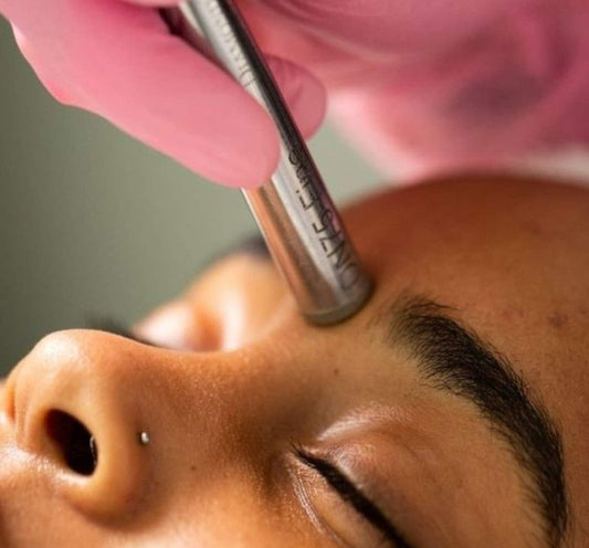 Microdermabrasion
